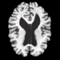 Vent volume traversal